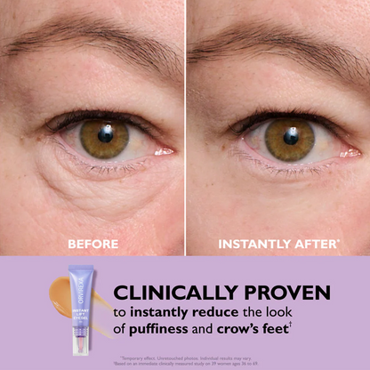 Instant Lift Eye Gel – Fast Acting for Puffiness & Under Eye Bags, Smooth Fine Lines, 0.34 oz