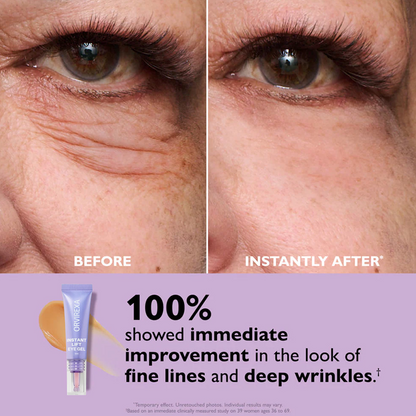 Instant Lift Eye Gel – Fast Acting for Puffiness & Under Eye Bags, Smooth Fine Lines, 0.34 oz