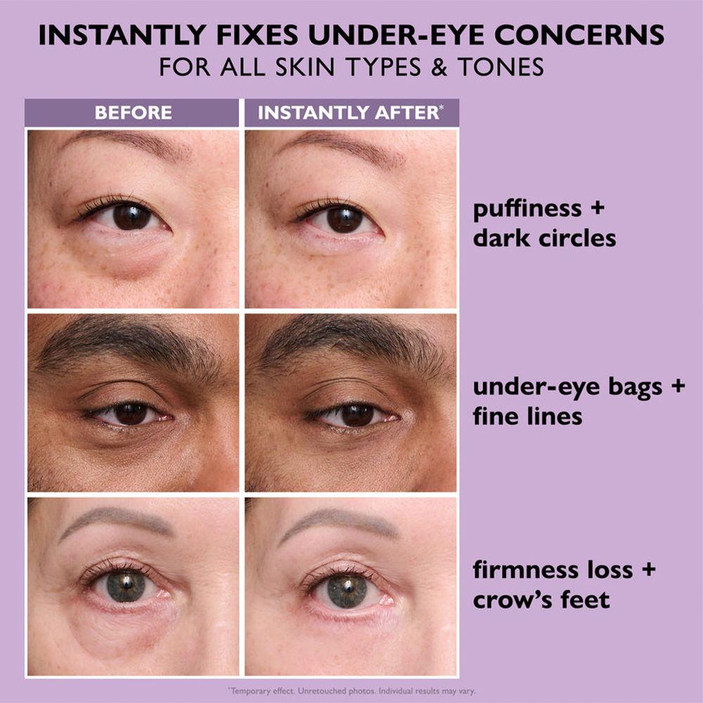 Instant Lift Eye Gel – Fast Acting for Puffiness & Under Eye Bags, Smooth Fine Lines, 0.34 oz